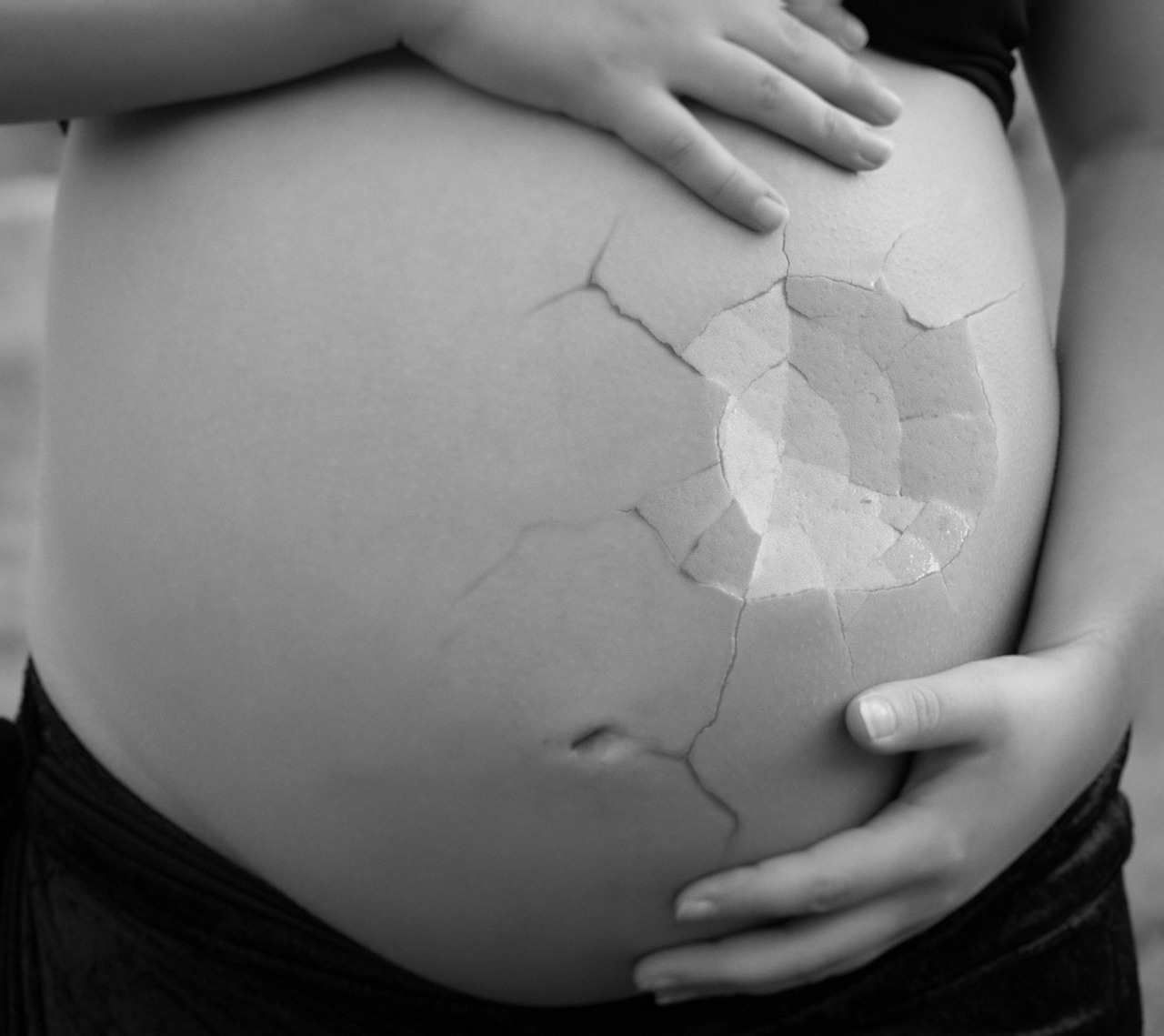 Poronienia nawykowe – jak zmniejszyć ryzyko występowania?